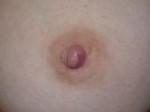 Nipple - Inversion Correction