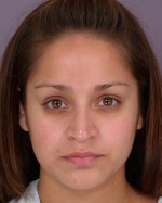 Nose Reshaping