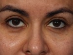 Skincare & Makeup Before and after photo