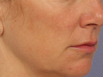 Medical Spa Services