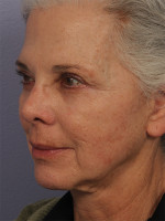 Medical Spa Services